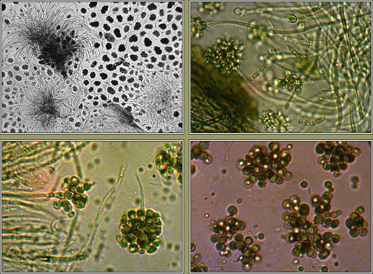 Cheirospora botryospora