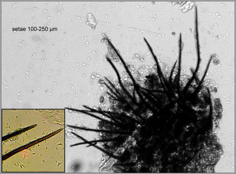 Colletotrichum dematium