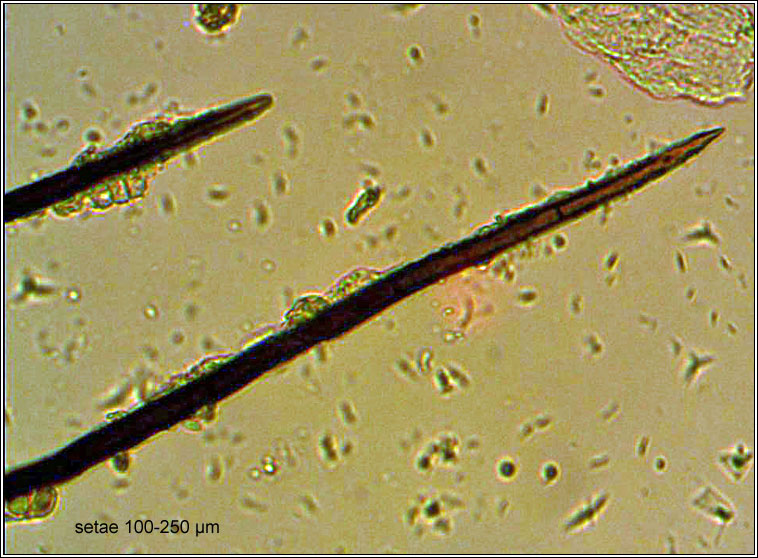 Colletotrichum dematium