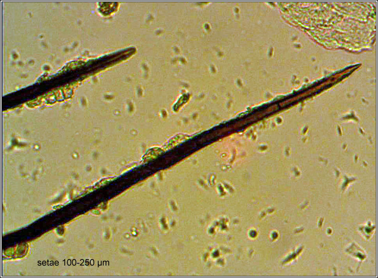 Colletotrichum dematium