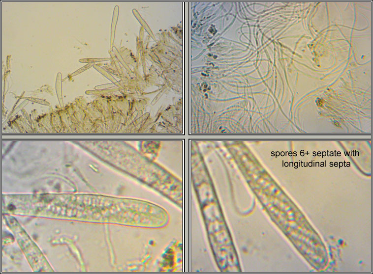 Claussenomyces atrovirens