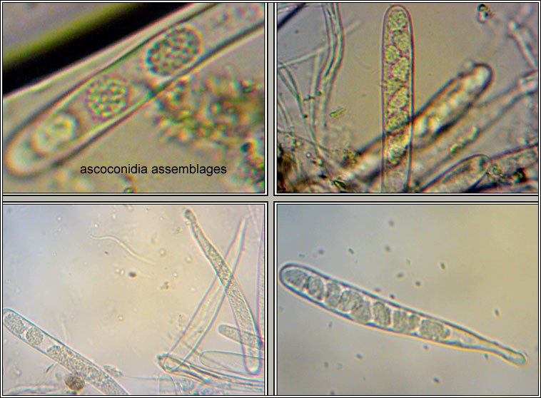 Claussenomyces atrovirens