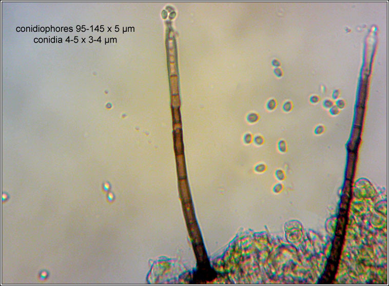 Chaetosphaeria - Chloridium