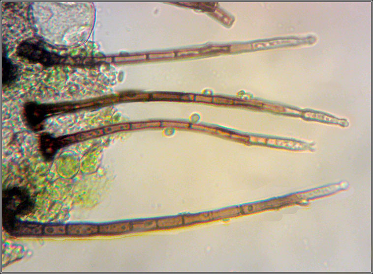 Chaetosphaeria - Chloridium