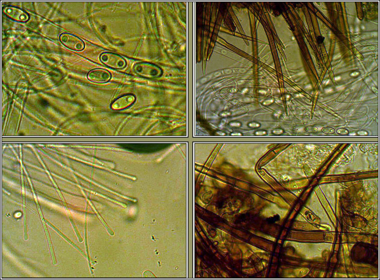 Trichophaea hemisphaerioides, spores