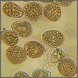 Puccinia menthae