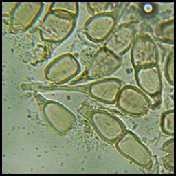 Puccinia annularis