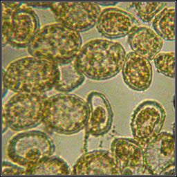 Pucciniastrum epilobii