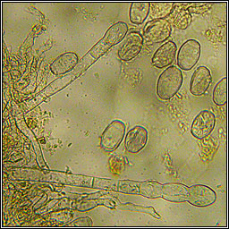 Podosphaera epilobii (Sphaerotheca epilobii)