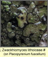 Zwackhiomyces lithoiceae