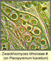 Zwackhiomyces lithoiceae