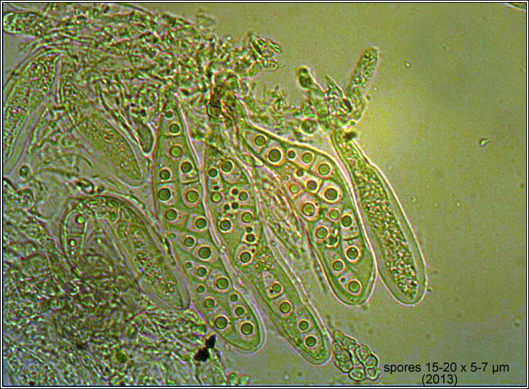 Zwackhiomyces lithoiceae