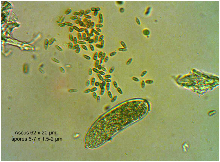 Muellerella lichenicola, ascus and spores