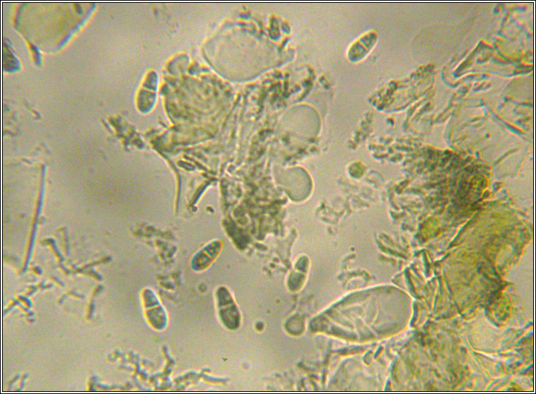 Arthonia didyma, spores