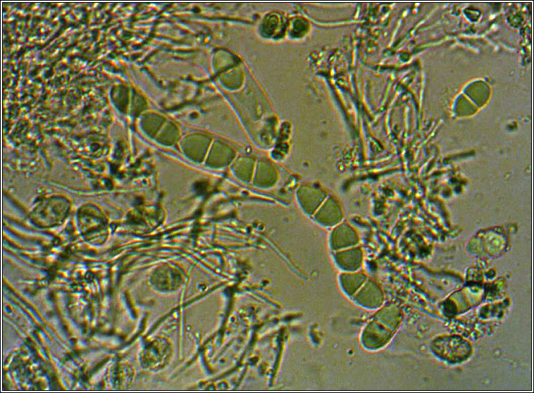 Acrocordia conoidea, asci and spores
