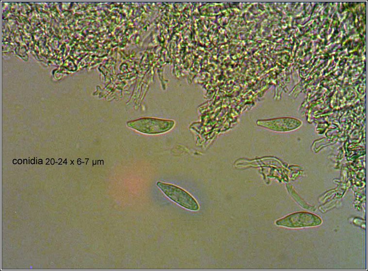 Hawksworthiana peltigericola