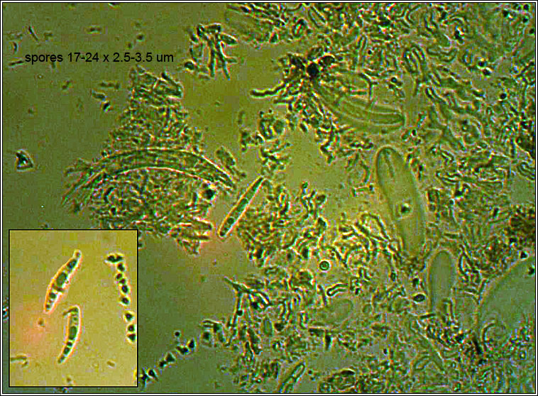Fellhaneropsis vezdae, spores