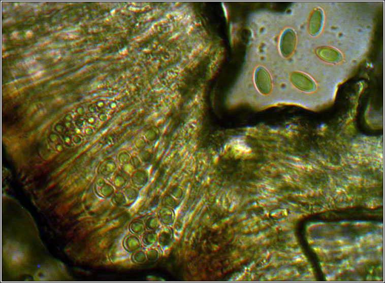 Lecanora gangaleoides
