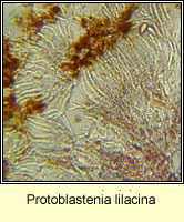 Protoblastenia lilacina