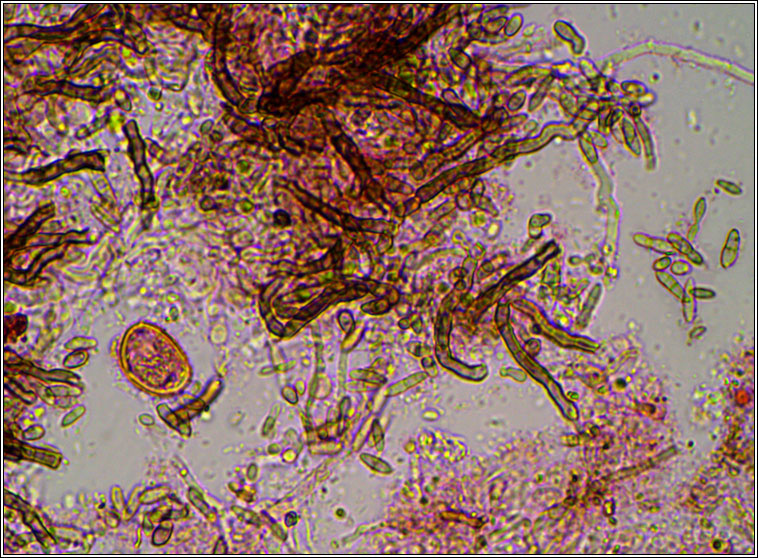 Gonatophragmium lichenophilum
