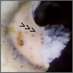 Microcera physciae