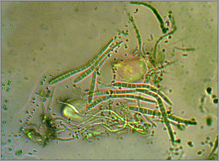 Bacidia laurocerasi