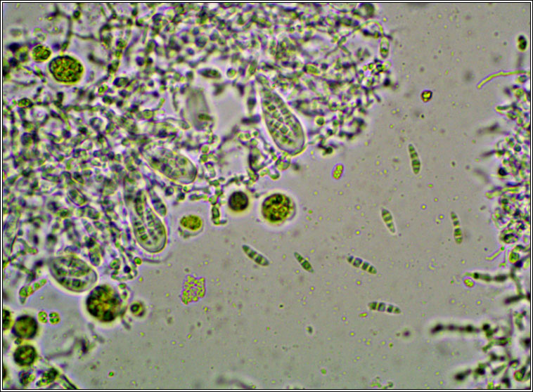 Chrysothrix flavovirens