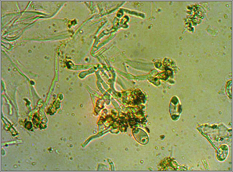 XXanthoria parietina