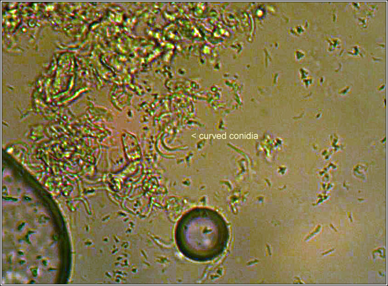 Lecanora conizaeoides, conidia