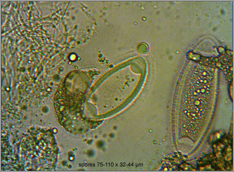 Pertusaria leioplaca, spores