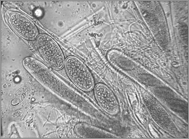 Pertusaria leioplaca, spores