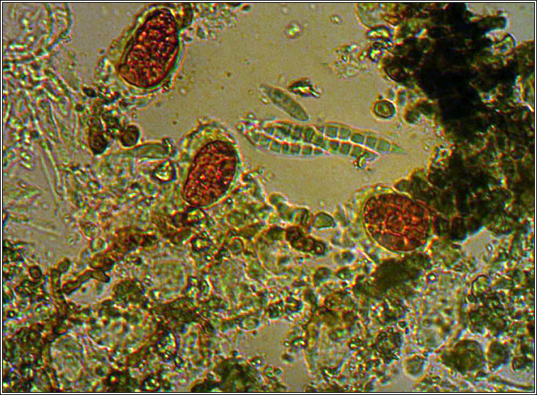 Porina linearis, spores