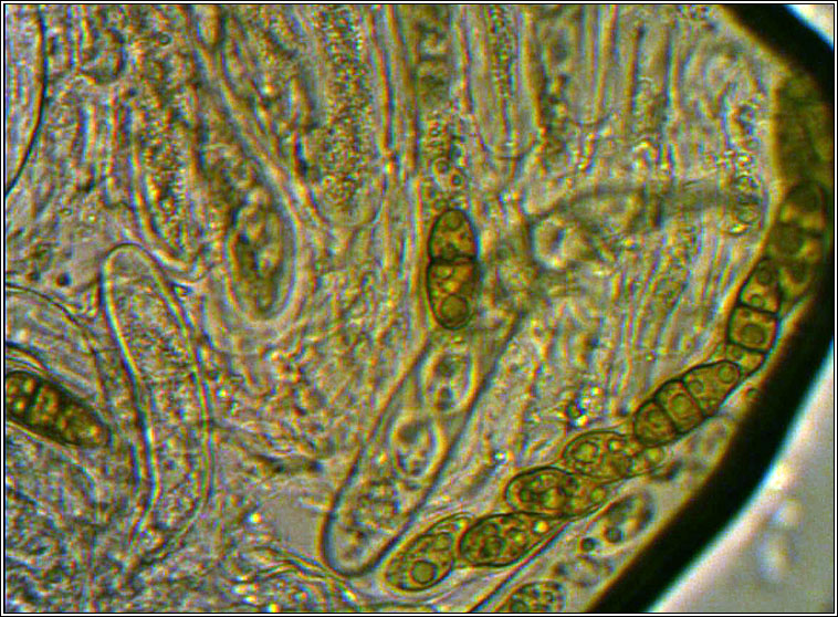 Weddellomyces epicallopisma