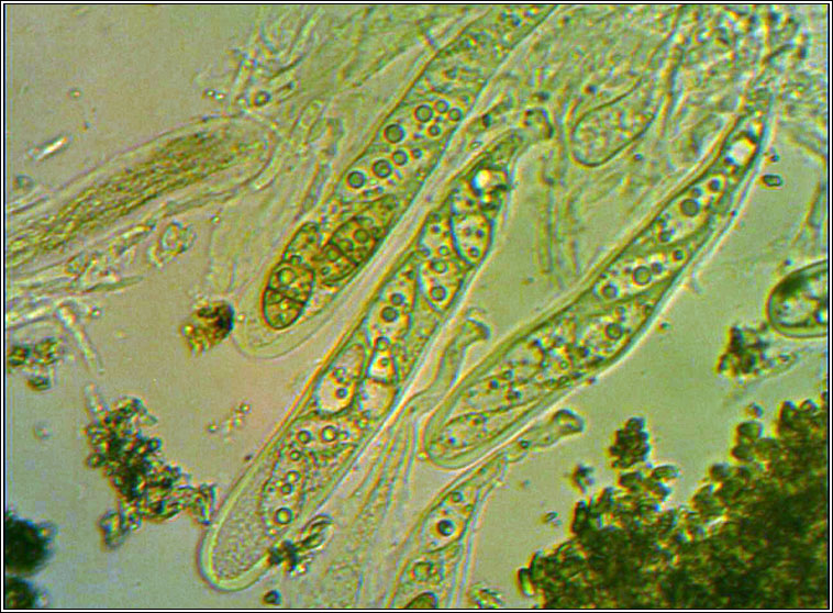 Weddellomyces epicallopisma