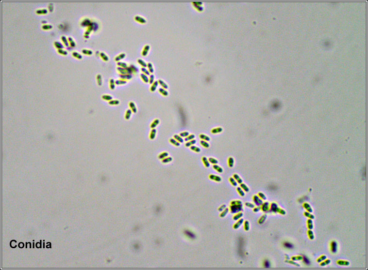 Micarea doliiformis, conidia