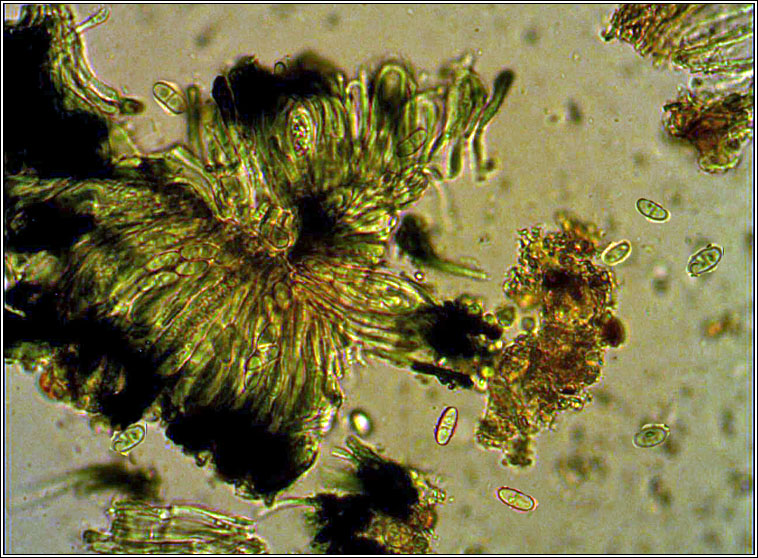 Toninia episema, spores