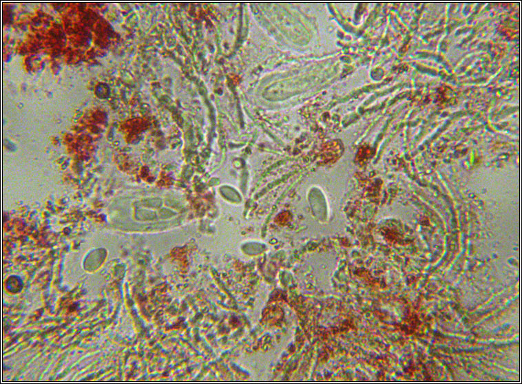 Protoblastenia incrustans