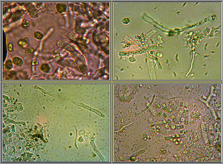 Syzygospora bachmannii