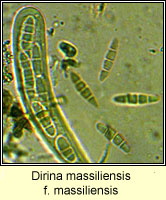 Dirina massiliensis f massiliensis