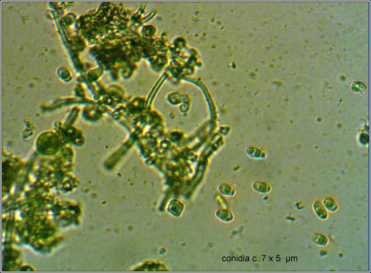 Vouauxiomyces truncatus