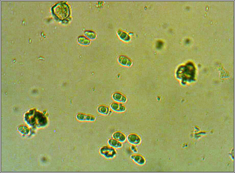 Vouauxiomyces truncatus