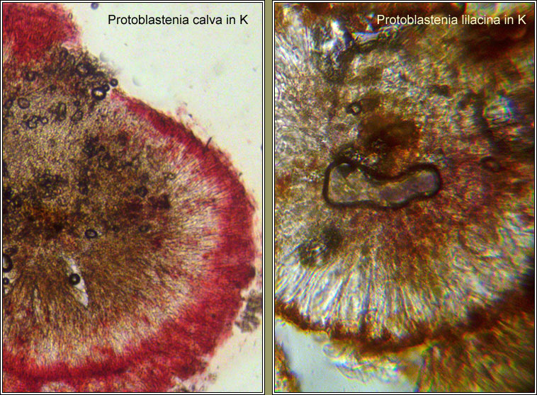 Protoblastenia lilacina