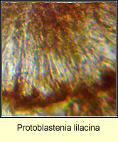 Protoblastenia lilacina