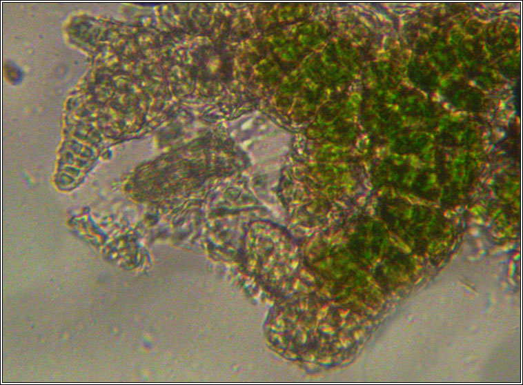 Psoroglaena stigonemoides