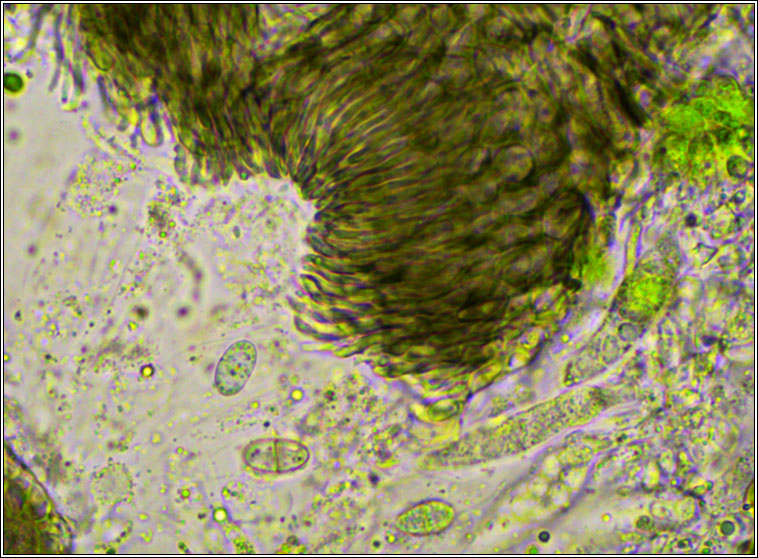 Lichenochora physciicola