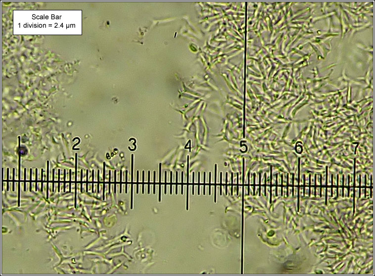 Spirographa skorinae