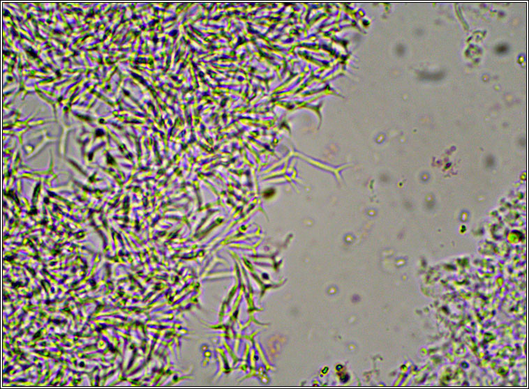 Spirographa skorinae