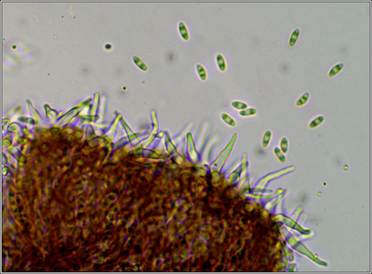 Unguiculariopsis lesdainii