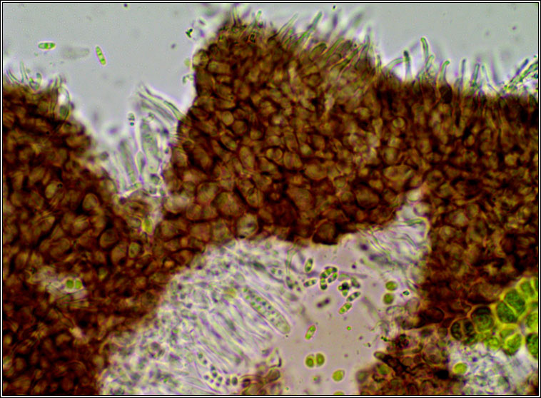 Unguiculariopsis lesdainii