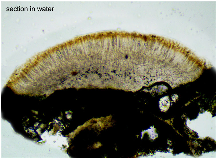 Lecanora argentata